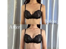 ジョリー(Jolie)/