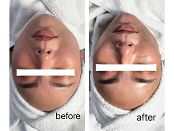 ベルエス(bell.s)/小顔ケアお任せください!