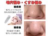 【１か月以内のお客様限定】毛穴の黒ずみと開きを徹底洗浄＆吸引で陶器肌★