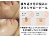 【黒ずみ・角栓悩みの方】皮脂・常在菌チェック付/スキングローピール¥9900