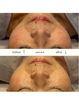 ビーエヌ エステティックアンドスパ(BN Esthetic&Spa)/60代ムルトクス