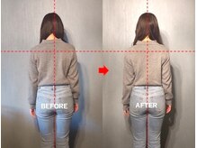 アトラス/初回のお客様のBefore＆after