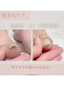 【Foot】巻き爪ケア＋爪周りケア ¥11000