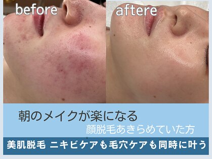 アロマ(AROMA)の写真