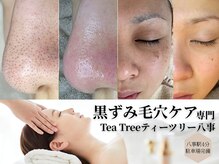 ティーツリー(Tea Tree)