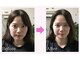 アイキ(aiki)の写真/【顔の歪み・エラ張り・フェイスライン・ほうれい線】1ミリ単位で変化にこだわるワンランク上の小顔矯正!!