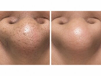 メンズビューティーハウス(Men-s Beauty House)の写真/リラックス空間でヒゲ脱毛や肌ケアをもっと身近に！メンズ専用サロンが第一印象作りを応援します！
