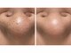 メンズビューティーハウス(Men-s Beauty House)の写真/リラックス空間でヒゲ脱毛や肌ケアをもっと身近に！メンズ専用サロンが第一印象作りを応援します！