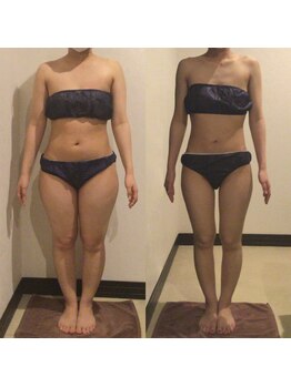 アユアラングレース/手ごわい太ももが-9.6cm!