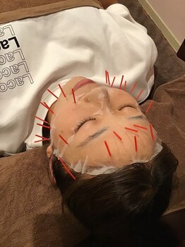 鴨居よつば整骨院/ヒト幹細胞パック＋美容鍼