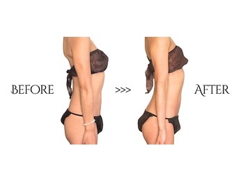 リュシータ 吹田千里丘店(LUSHEETA)/【 VENUS痩身 】(30代後半)