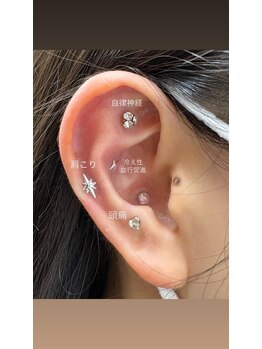 マーレ(MARE)/耳つぼジュエリー