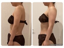 ボーテ(beaute)/【ビフォーアフター】