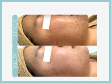 アコガレコガオ 秋田店/