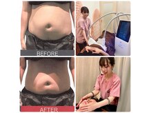 スポットスリム(SPOT SLIM)