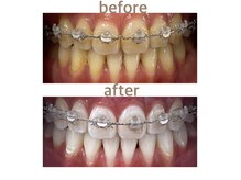 セルフホワイトニング専門店　 ホワイトニングショップ船橋2号店【ホワイトニング】の雰囲気（ホワイトニング船橋/船橋ホワイトニング/船橋ホワイトニング）