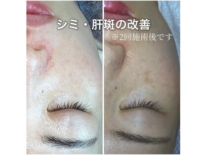 ウェリナ(Welina)の写真