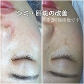 ウェリナ(Welina)