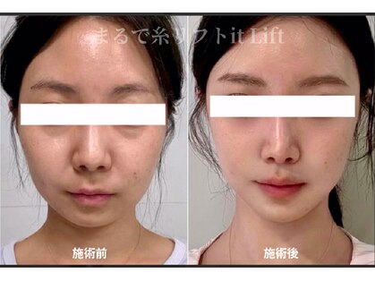 ビューティーネイル(Beauty Nail)の写真