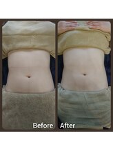 ミューク 自由が丘(mjuk)/お腹スッキリ◎お腹セラピー