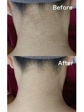 レアマカナ(LeaMakana)/ビフォーアフター