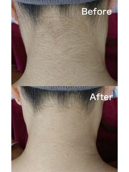 レアマカナ(LeaMakana)/ビフォーアフター