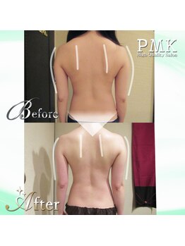 PMK 船橋店/造形パワーツリーコース2回施術