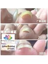 3回目の巻き爪施術お客様写真