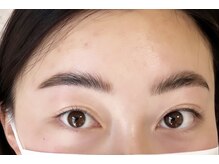 アイリー(IRIE)/海外風ハリウッドブロウリフト