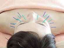 からだとこころ 恵比寿/美容鍼