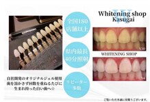 ホワイトニングショップ 春日井店(whitening shop)