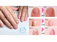 クリアー 日本橋小伝馬町(Clear)/ウォーターケアで自爪を育てる！