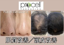 ルイース(LOUISE.)