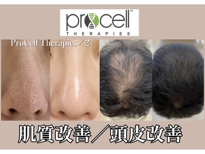 ルイース(LOUISE.)の写真