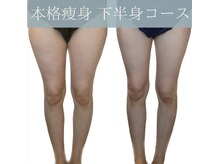 レイアス(Ray as)/太ももの外張り軽減♪