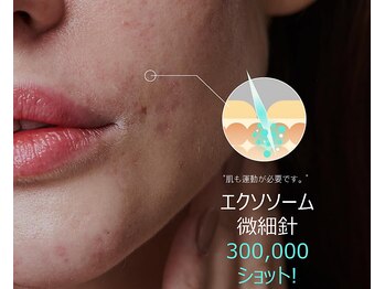 ピービー(PB)/メソプロ（MESOPRO+）