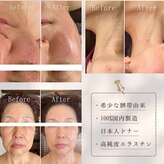 サロン アイプラス(salon i plus)