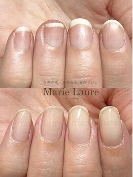 マリーロール 天王寺店(Marie Laure)/深爪矯正/自爪育成/ネイルケア