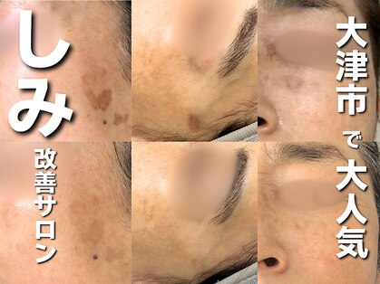 ビュキュアの写真