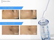 エモーショナル 姫路(Emotional)の雰囲気（完全予約制◎ハーブピーリング/ニキビケア/毛穴/ララピール/）