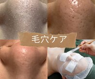 ピュリフィケーション(Purification)