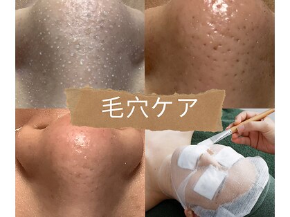 ピュリフィケーション(Purification)の写真