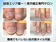 ブルームーンネイルズ(BLOOMOON.nails)の雰囲気（症例実績５万件以上の岐阜エリア初のリプロネイル登録店！）