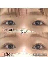 アールアイ(R-i)/アイリッドアップパーマ
