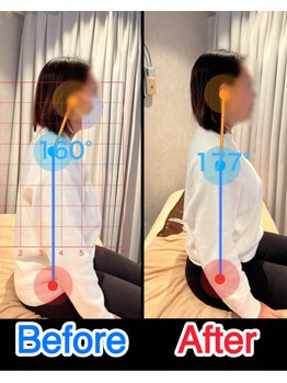 笑う門 新小岩店/女性の姿勢チェック