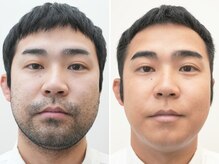 ミダシー 千葉店の雰囲気(男性の顔の印象を変える!!脱毛・アイブロウなどメンズサロン)