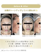 private salon SORA/輝きを育む幹細胞ピーリング