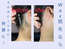 ビューティーサロン ビビ(Vivi)/WAX脱毛で瞬間的にうなじ美人に