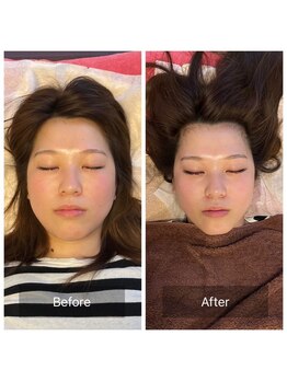 美容整体サロン プライム(Prime)/小顔矯正　ビフォーアフター