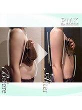PMK 船橋店/造形パワーツリーコース2回施術